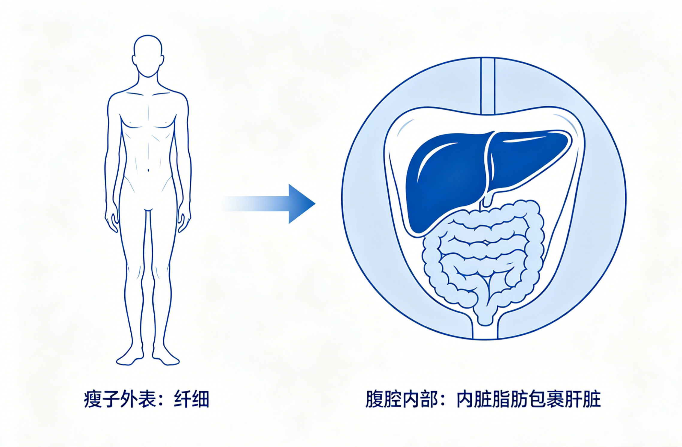 身材看着很瘦,体检却查出脂肪肝?原来根源不在体重